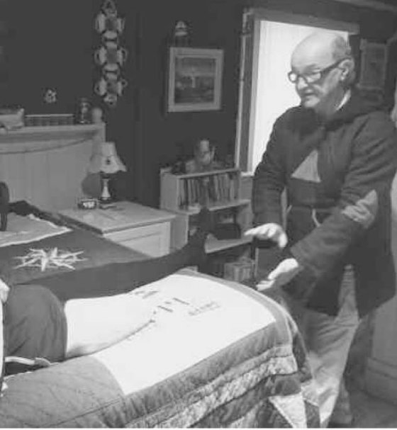 Cette photo montre comment Bernard Dubreuil fait pour allonger le membre fantôme de Katherine jusqu'à ce qu'il ait la longueur de l'autre jambe